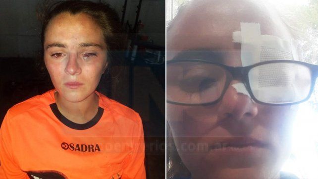 Brutal agresión a una jueza de fútbol femenino de Paraná
