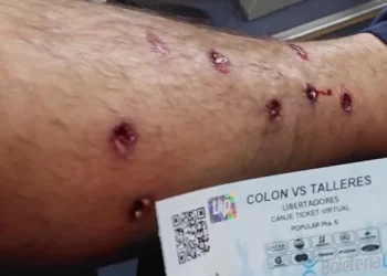 Un grupo de hinchas de Talleres denuncia represión de la Policía de Santa Fe 