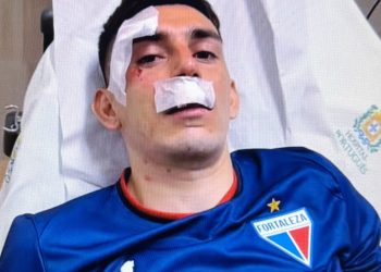 Salvaje agresión al plantel de Fortaleza: Escobar y Brítez entre los heridos